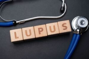 Mengenal Lupus Penyakit dengan Gejala Beragam